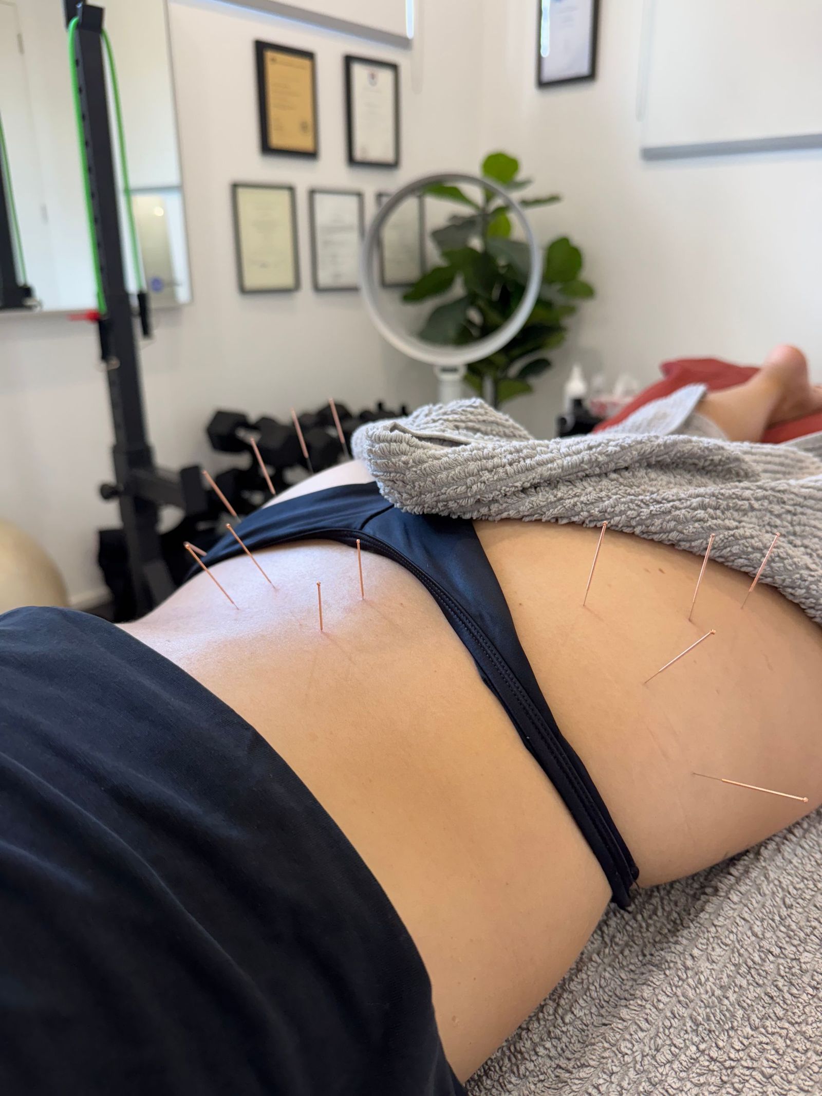 Sciatica or something else? How physios tell the difference | PACT Physio Miranda
